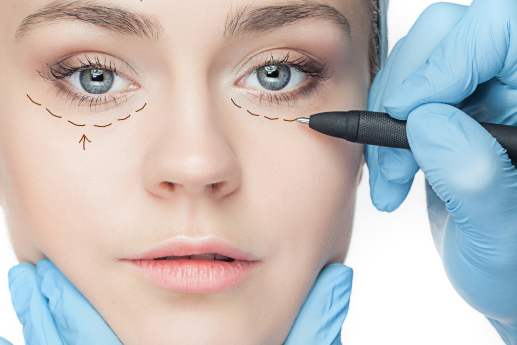 Blépharoplastie ou chirurgie des paupières aux Sables d'Olonne