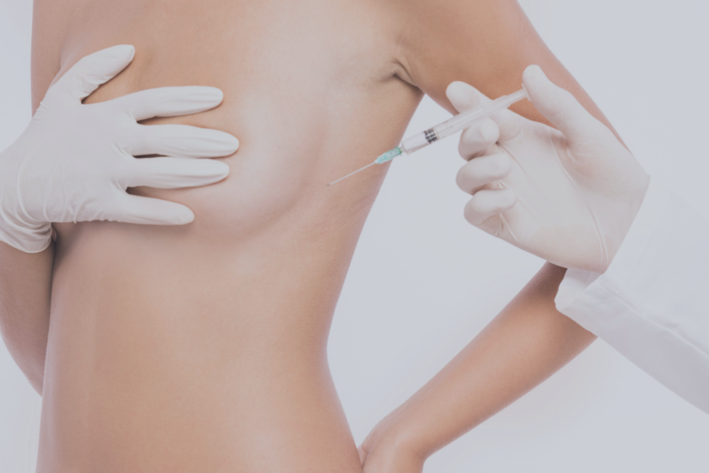 Augmentation mammaire par lipofilling aux Sables d'Olonne