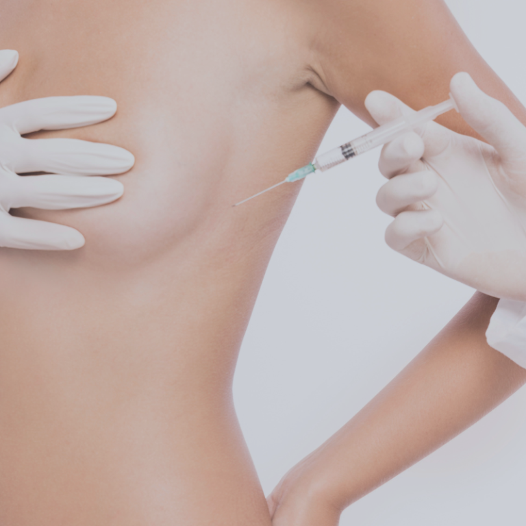 Augmentation mammaire par lipofilling aux Sables d'Olonne